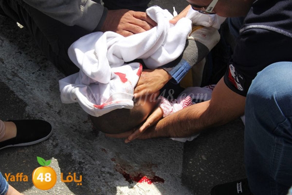 kid accedent lud 0401 (3).JPG